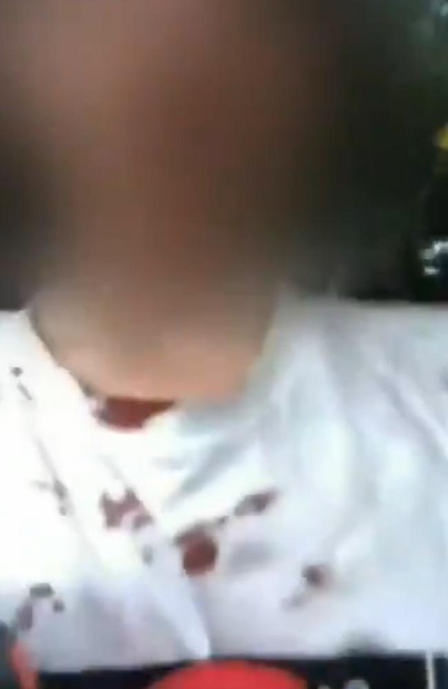 The teen with blood splatters on his shirt, posted on Instagram after the crash.