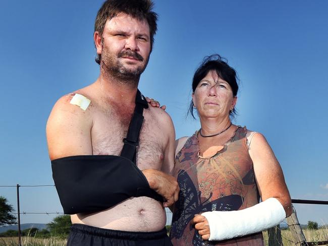 EMBARGOED FOR MARCH 11, 2018 - LOCKED NEWS 360 PREMIUM CONTENT - NOT FOR THE AUS or NEWS.COM.AU  Berdus Henrico 39, and Estelle Nieuwenhuys 51, who are engaged, were attacked on the evening of Tuesday, February 6, inside a game park in the Limpopo Province. Berdus fought with two men who attacked with a knife and screwdriver, after which a third man came in to their remote farmhouse with a handgun and shot him three times. He is lucky to be alive.  **NO BYELINE**