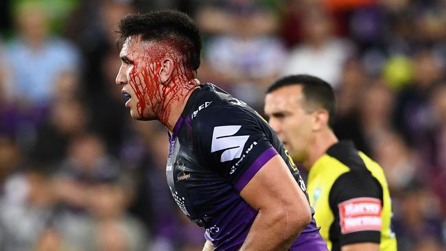 Melbourne Storm’s Nelson Asofa-Solomona bleeds heavily from the head. Picture: Quinn Rooney/Getty Images