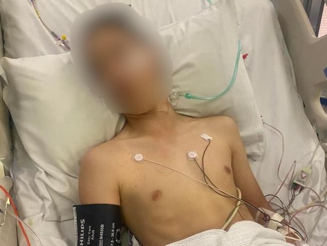 Teen in near-fatal skatepark attack wakes after marathon surgery