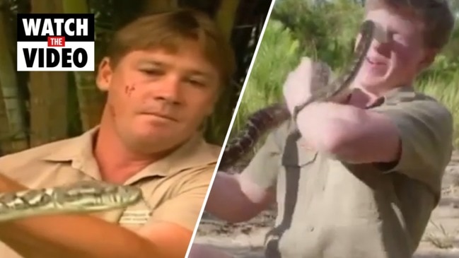 Crikey! Robert Irwin bitten on face by snake