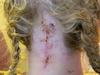Woman at risk of ‘internal decapitation’