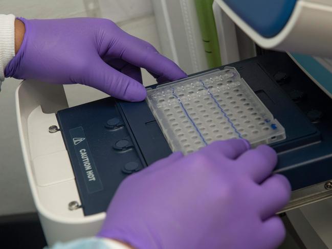 Samples from the USS Theodore Roosevelt are tested at the US Naval Medical Research Centre. Picture: AFP