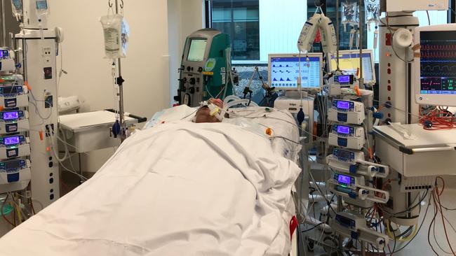 Jason 'Buddy' Miller, 48, of Queenscliff, survived severe sepsis, but will lose both his hands and his feet. Pictured in ICU at Northern Beaches Hospital. Picture: Supplied. 