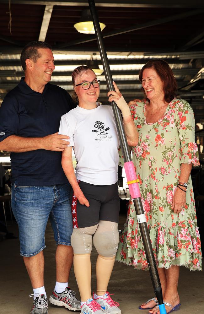 Sophie Delezio pictured with her dad Ron and mum Carolyn.