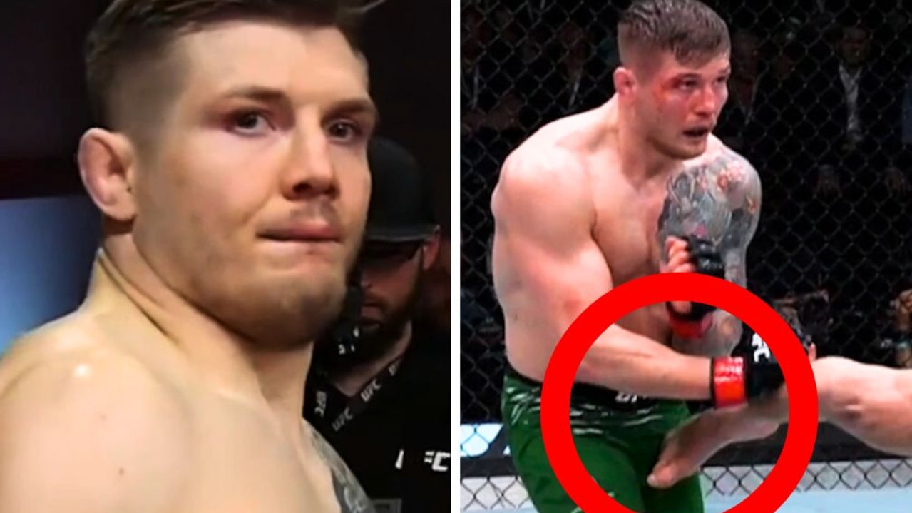 UFC star’s embarrassing wardrobe blunder