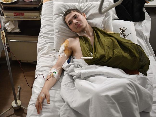 A 19 year old Ukrainian soldier named Yevhen lays in bed in a military hospital in Lviv on March 01, 2022, after being injured by a mine in the Luhansk region. (Photo by Daniel LEAL / AFP)