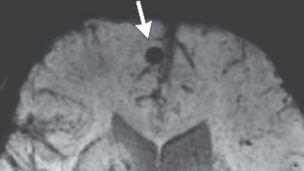 Disgusting find in man’s brain