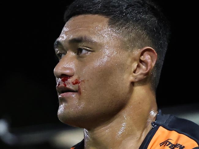 SYDNEY, AUSTRALIA - JULY 06: Stefano Utoikamanu of the Wests Tigers leaves the fiels with a bloody nose and ripped shirt during the round 18 NRL match between Wests Tigers and Melbourne Storm at Leichhardt Oval, on July 06, 2024, in Sydney, Australia. (Photo by Scott Gardiner/Getty Images)