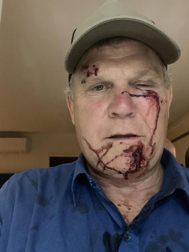 Former Barron River MP Michael Trout has been charged in relation to a brawl in Holloways Beach in May, 2024. Picture: Supplied