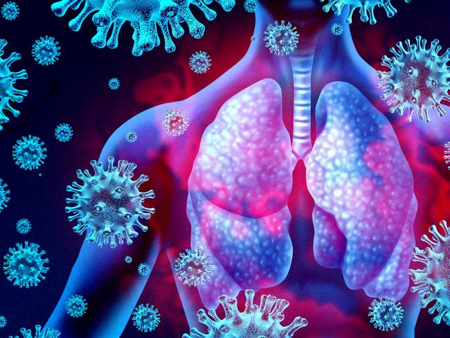 Lung virus infection and coronavirus outbreak or viral pneumonia and coronaviruses influenza as a dangerous flu strain cases as a pandemic medical health risk concept with disease cells with 3D render elements.