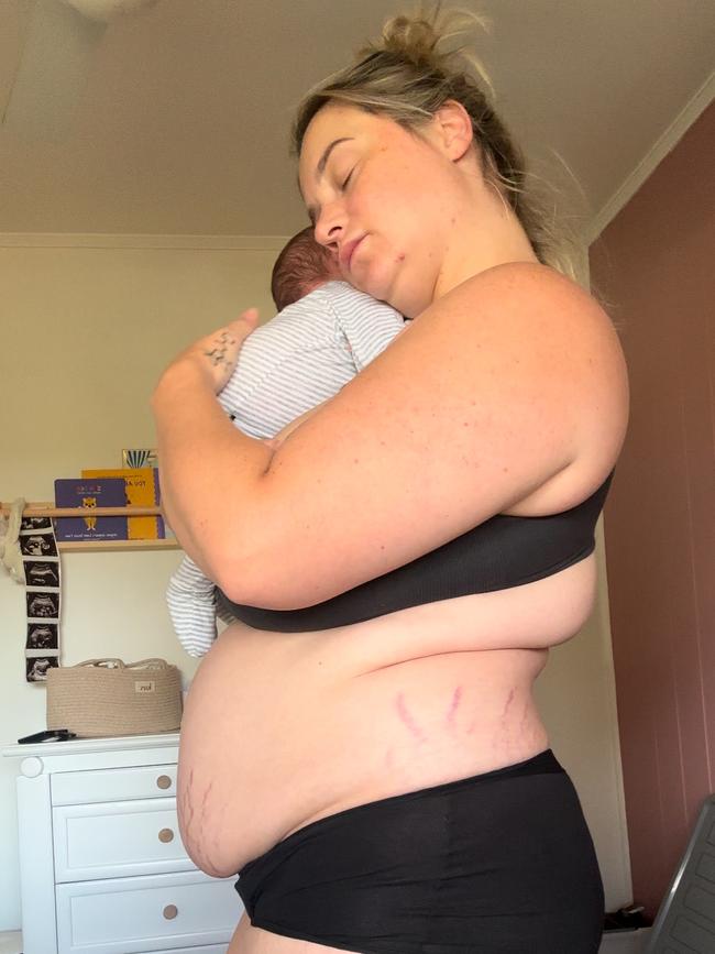 Ms Mitchell post-partum. Picture: Supplied
