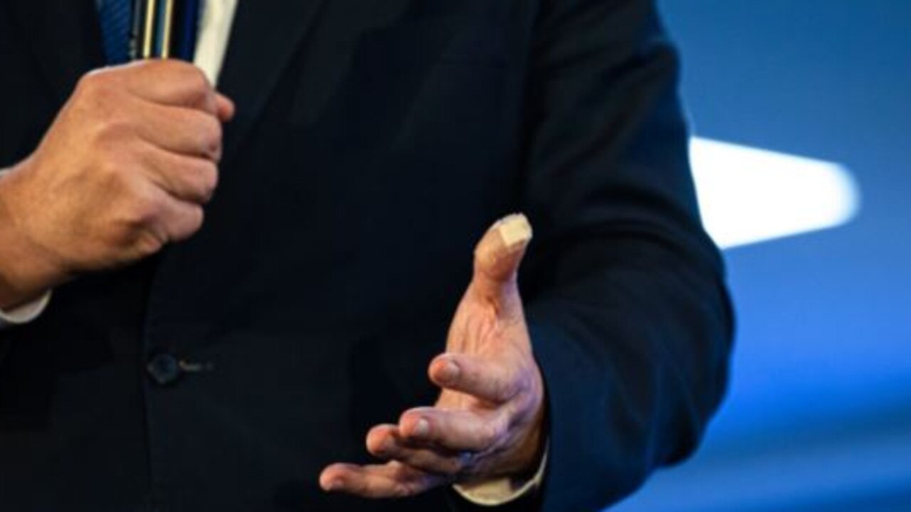 Morrison's bandaged left thumb.