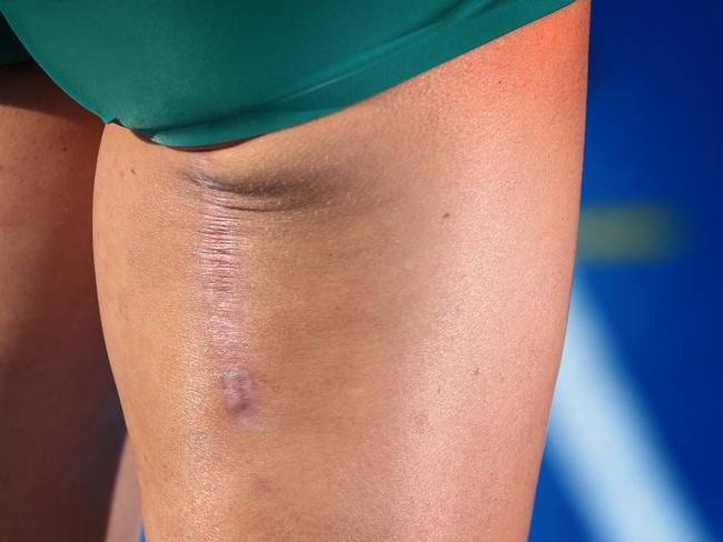 Celeste Mucci’s scar from her hamstring surgery is a constant reminder of what she’s gone through to get to Paris. Picture: David Caird