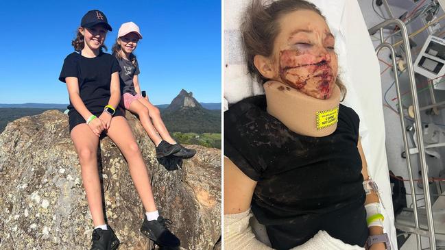 Cheyanne and her sister Indy on top of Mt Ngungun, and Cheyanne in hospital after her fall on October 29. Picture: Facebook