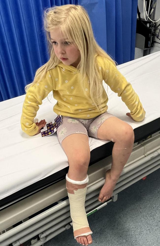 Ava, 4, broke her ankle when she fell from the high equipment at the playground on Wharf Rd, Batemans Bay.