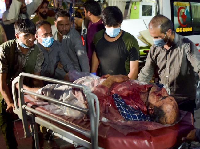 A civilian who was wounded in the deadly ISIS suicide bombings in Kabul is rushed to hospital. Picture: AFP