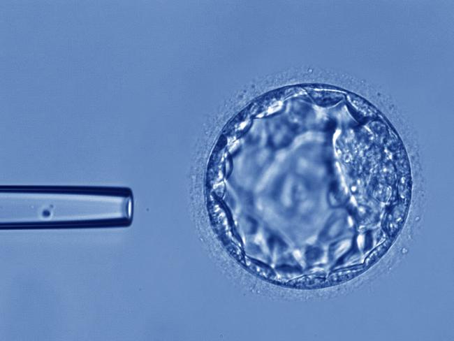 File photo of an embryo in an IVF lab.