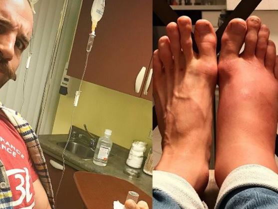 Patrick Cummins shared a gruesome photo of his feet.