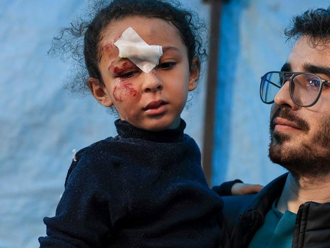 EDITORS NOTE: Graphic content / A child injured during Israeli bombardment receives treatment at the Kuwait Hospital in Rafah in the southern Gaza Strip on December 20, 2023, amid ongoing battles between Israel and the Palestinian militant group Hamas. (Photo by SAID KHATIB / AFP)