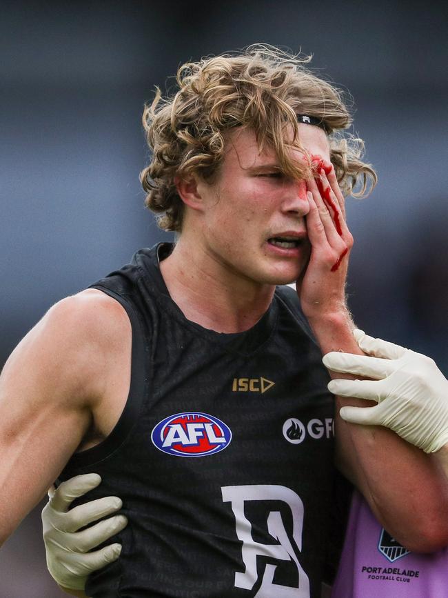 Xavier Duursma after clashing heads. Picture: Matt Turner/AFL Photos via Getty Images