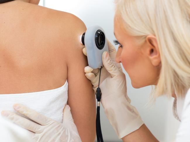 Images of malignant and benign lesions will help identify Melanoma. Picture: Thinkstock