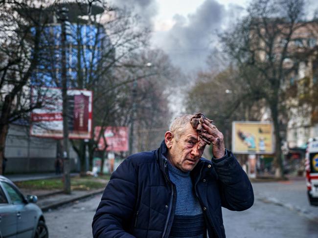 TOPSHOT - An injured man stands on a street after Russian shelling to Ukrainian city of Kherson on December 24, 2022, where five were killed and 20 injured. - Ukrainian President Volodymyr Zelensky on December 24, 2022 blasted Russian "terror" after shelling left at least five dead and 20 injured in Kherson city, which Kyiv's forces recaptured in November. (Photo by Dimitar DILKOFF / AFP)