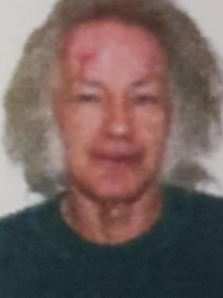 Milat’s mugshot in his 60s with self-inflicted forehead rash.