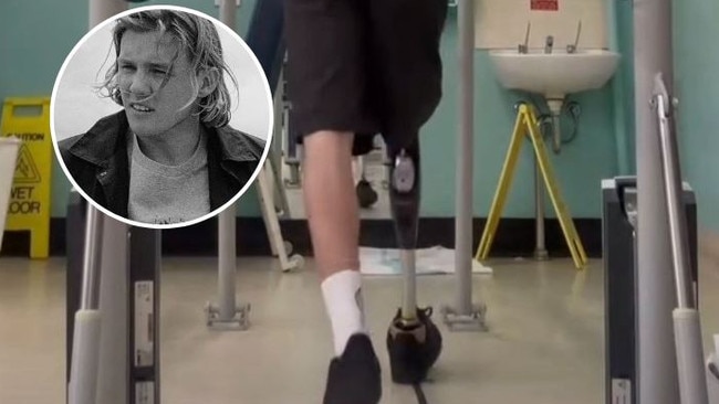 Mid-North Coast shark attack victim Kai McKenzie testing out his new artificial leg.