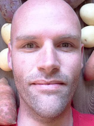 Andrew Taylor ate potatoes for a year to cure food addiction