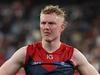 Oliver future unclear as Demons provide pre-season update