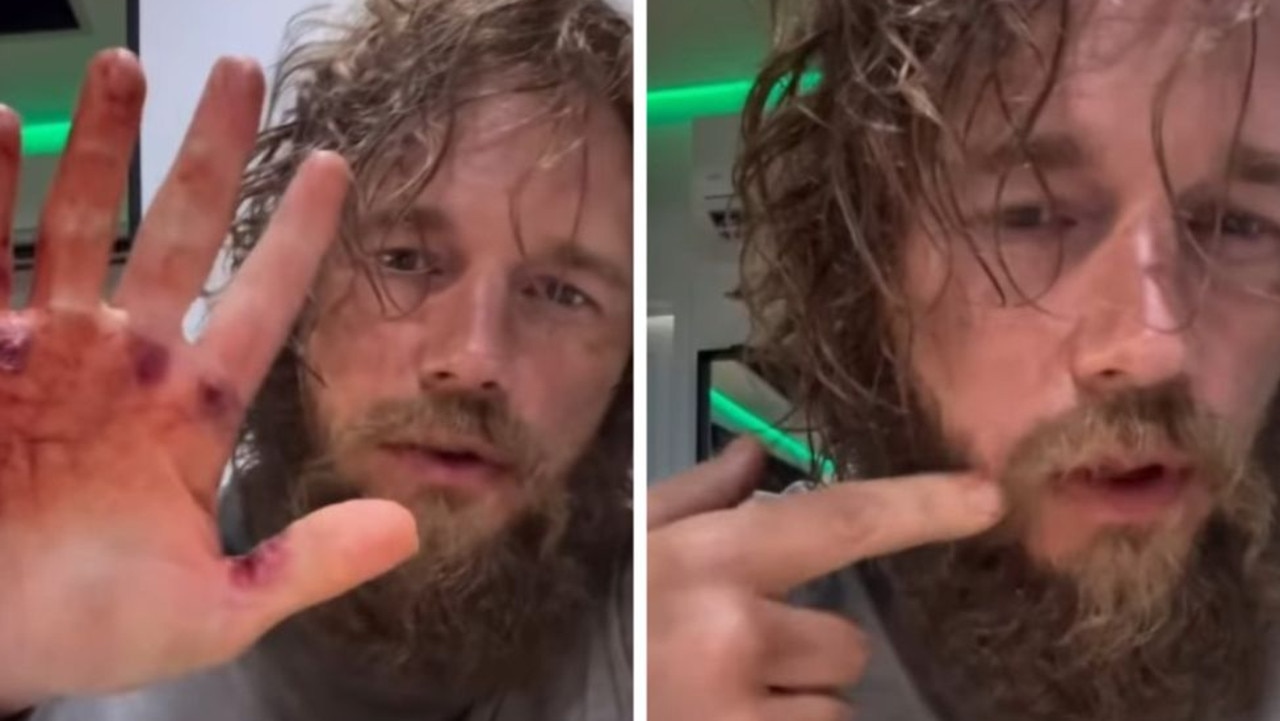 Marvel star unrecognisable in shock new vid