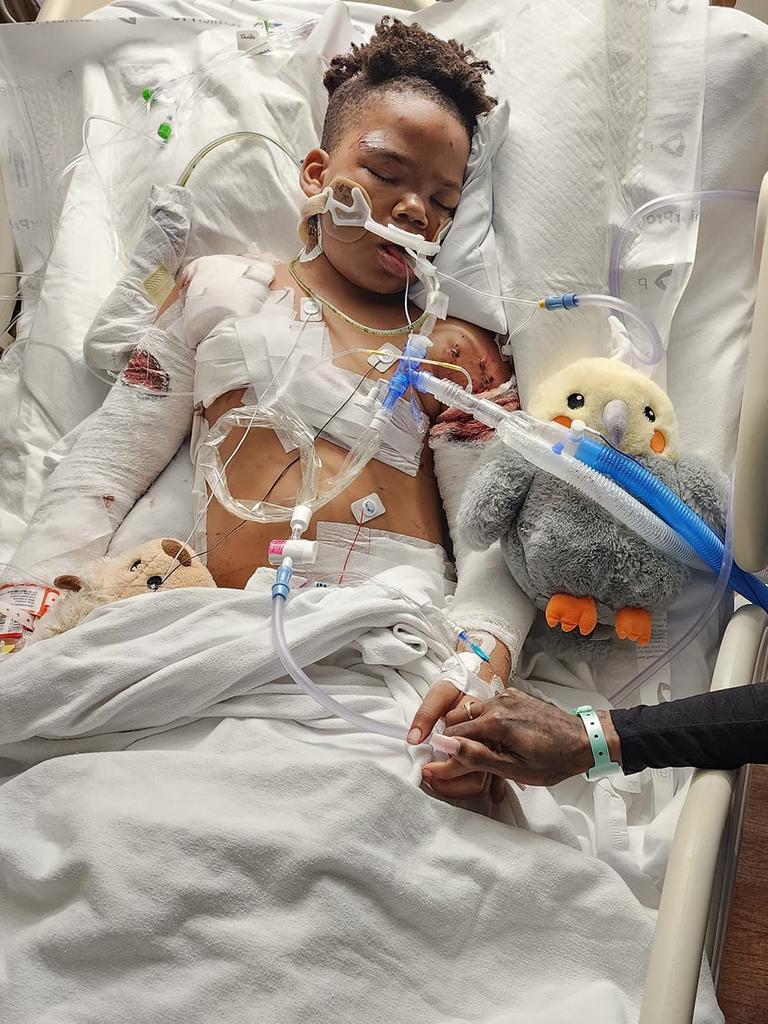 A’Rhyan was flown to hospital for surgery. Picture: Traci Fant