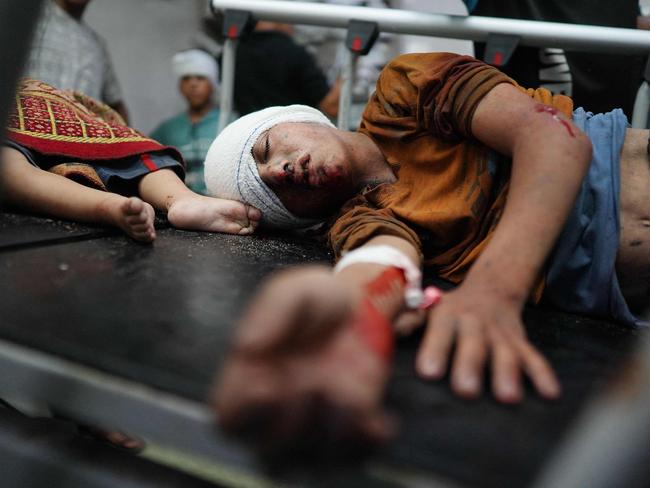 Palestinian children are treated at the Nasser hospital, where the injured and dead arrive following the Israeli targeting the southeastern district of Khan Yunis. Picture: AFP