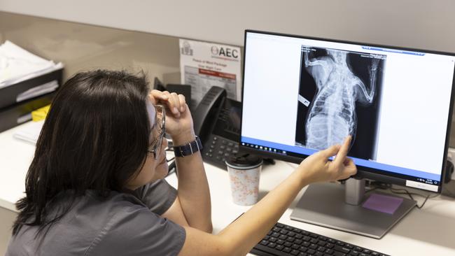 Dr Diana Chua checks an x-ray to determine treatment. Picture: Mark Cranitch