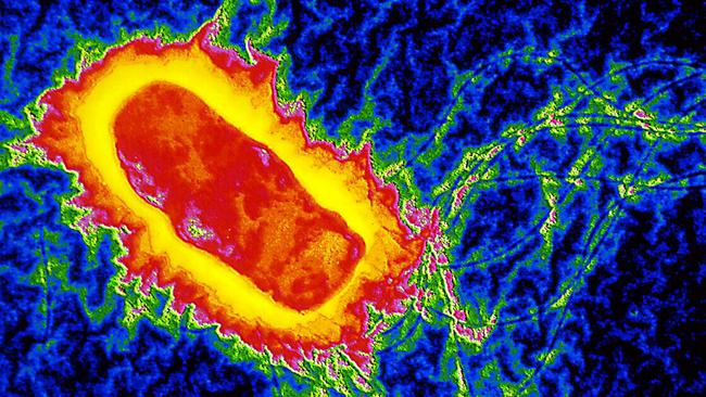 Salmonella bacteria viewed under a microscope.