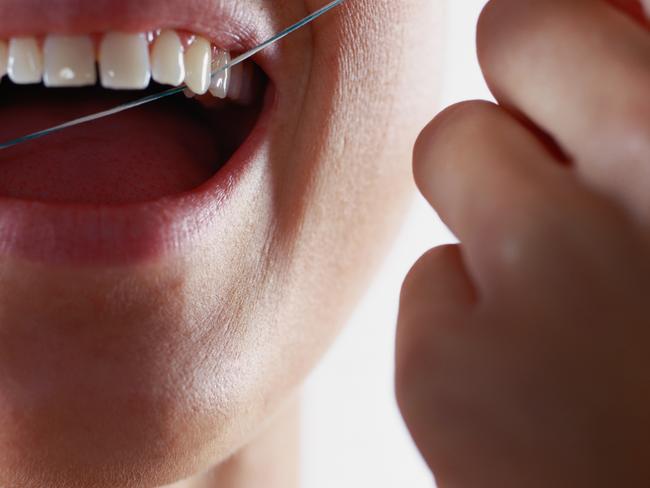 Flossing shouldn’t take a holiday as it helps to keep decay-causing bacteria away. Picture: Supplied