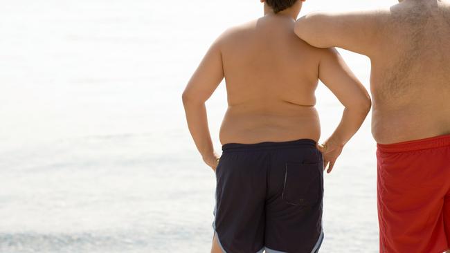 Weight loss surgery didn’t stunt the growth of children, the study found. Picture: Getty