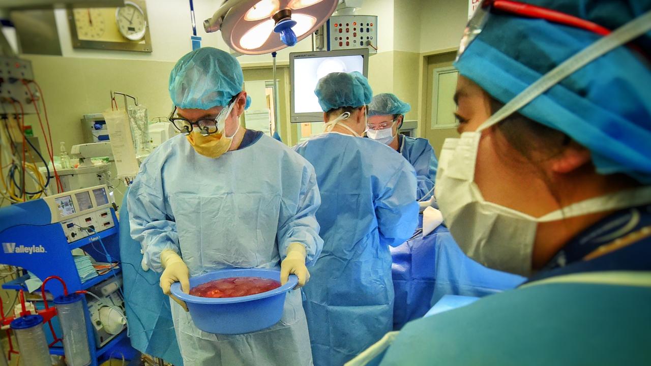 Medical staff perform a kidney transplant at Royal Melbourne Hospital. Picture: Tony Gough