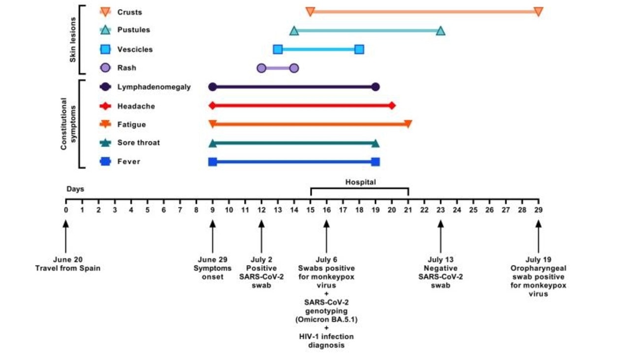 A timeline of the mans symptoms and tests. Picture: Journal of Infection.