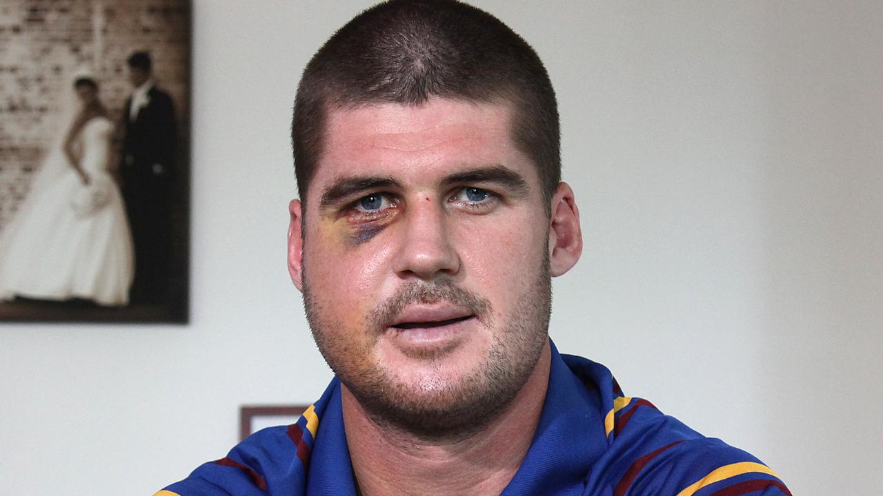 AFL: Jonathan Brown recalls horrific facial injury in 2011, footy ...