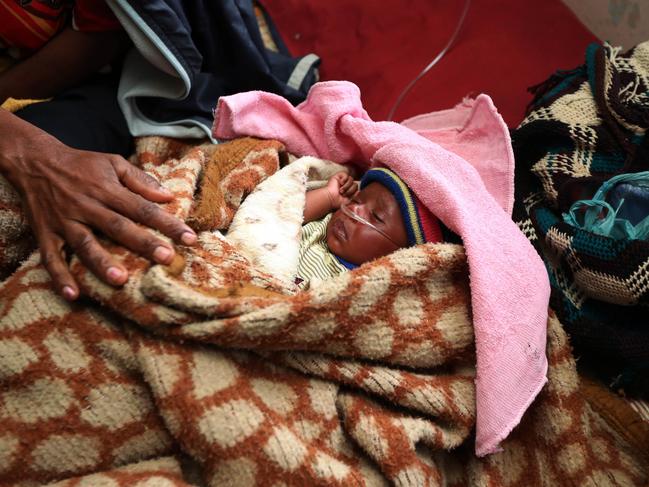 Tiny newborn Mutina is suffering from pneumonia and asthma. Picture: Gary Ramage