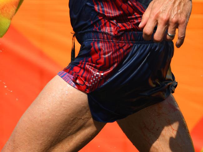 France's Yohann Diniz sponges away blood as he competes in the Men's 50km Race Walk.