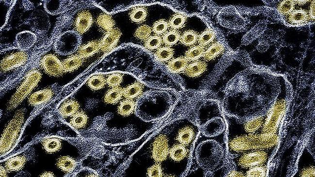 Micrograph of influenza A. Picture: CDC and NIAID/ AFP