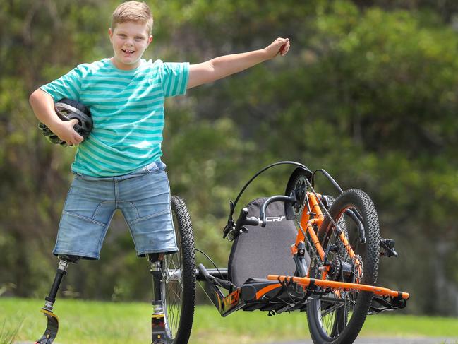 Ted, aged nine, with blade legs. Picture: Alex Coppel.