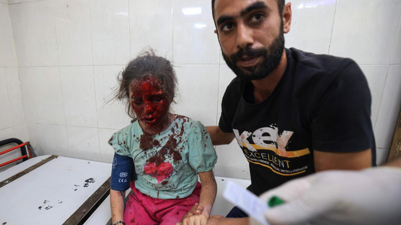 A Palestinian man sits with an injured girl at a hospital following Israeli strikes in the southern Gaza Strip overnight. Picture: AFP