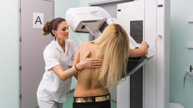 Breast cancer is generally higher in more affluent areas. Picture: iStock