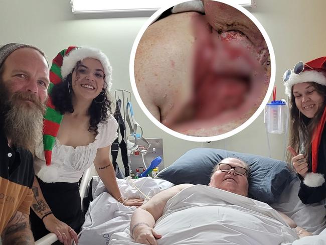 ‘Ringing my children to say goodbye’: Flesh-eating bacteria nearly kills mum