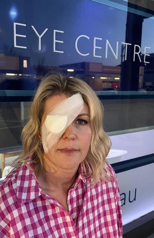 Grant Denyer's wife Chezzi Denyer shares photo of bandaged eye on Instagram