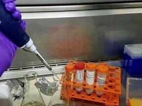 Science labs around the world are racing to find treatments and vaccines. Picture: Supplied